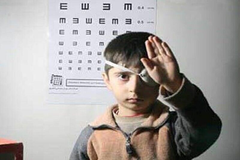 شناسایی ۲ هزار و ۶۱۵ کودک مبتلا به اختلالات بینایی در استان قزوین