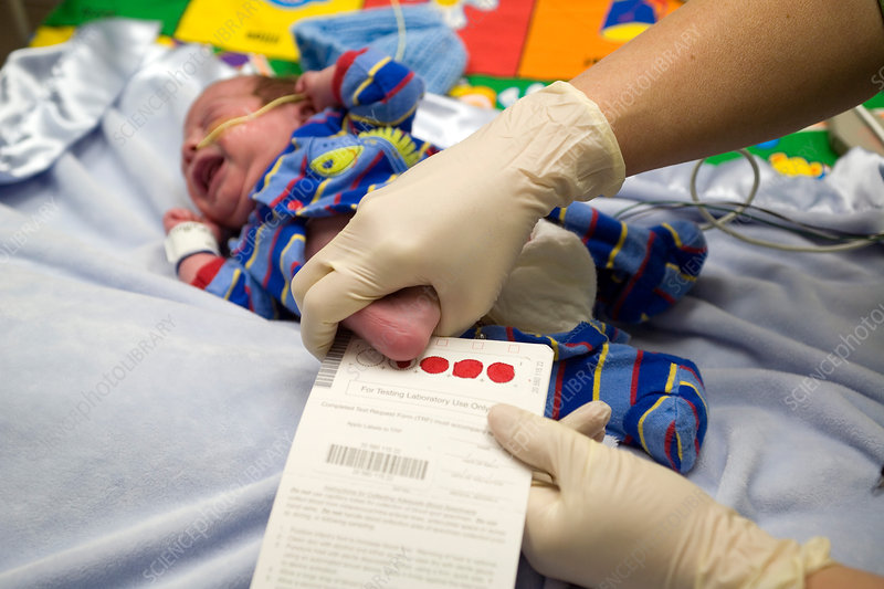 ۵۰ درصد والدین آزمایش خون ابتلا به فنیل‌کتونوری را برای نوزادشان انجام نمی‌دهند