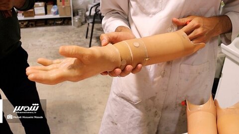 آ-شرقی- ساخت دست مصنوعی