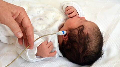 در سانه | مدیرکل بهزیستی استان
تولد سالانه حدود ۳۸ نوزاد با معلولیت‌های شنوایی در اردبیل