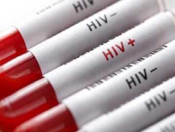 ۵۳ بیمار اچ آی وی تحت پوشش بهزیستی قزوین هستند