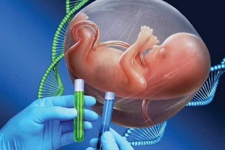 ۳۰۰ زوج زنجانی برای تولد فرزند سالم ازمشاوره ژنتیک استفاده کردند