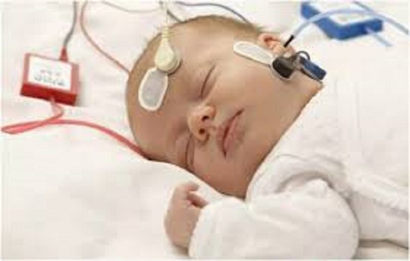 نزدیک به ۲ هزار نوزاد و کودک در شهرستان ابهر غربالگری شنوایی شدند