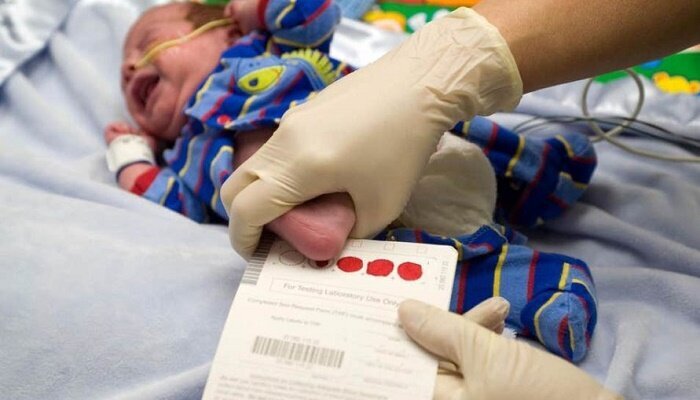 دو بیمار پی‌کی‌یو در رزن تحت پوشش بهزیستی؛ سال گذشته ۱۳.۵ میلیون تومان کمک‌هزینه دریافت کردند