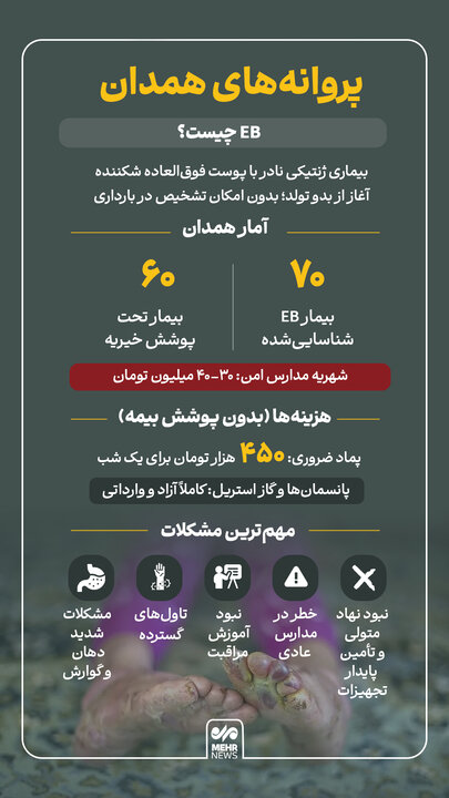اینفوگرافیک؛ مشکلات بیماران پروانه‌ای همدان