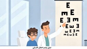 موشن گرافی| تنبلی چشم قابل درمان است